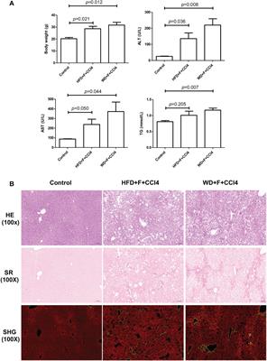 Characteristic gene expression in the liver monocyte-macrophage-DC system is associated with the progression of fibrosis in NASH